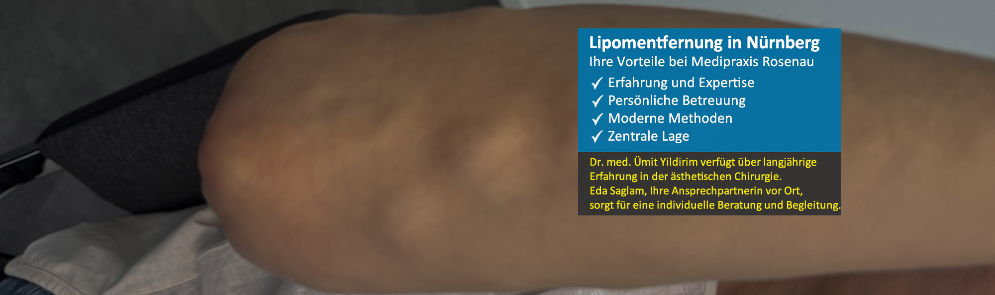 Lipomentfernung lang